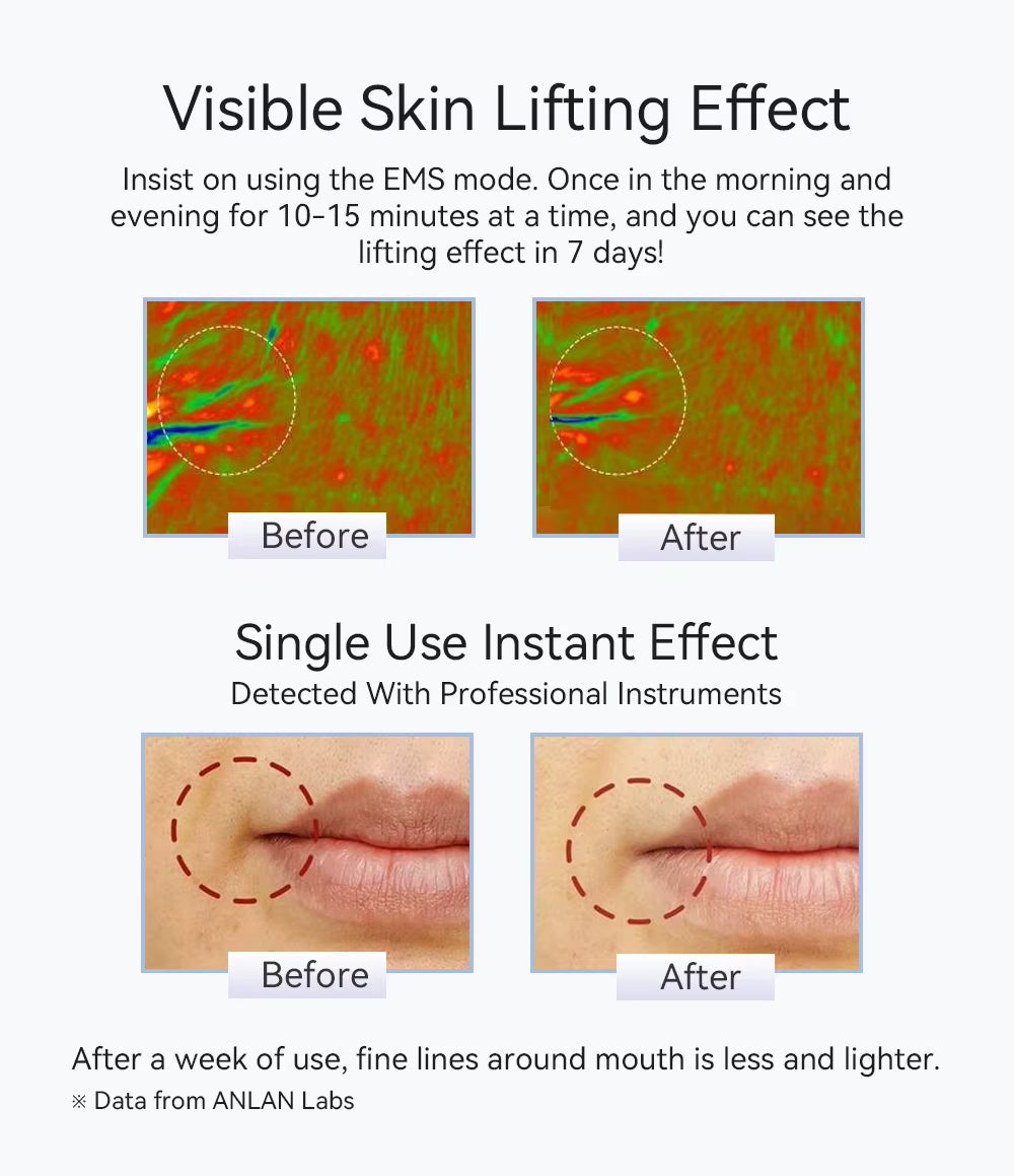 LumaTherapy™ Pro — Hot & Cold EMS Facial Lifting Wand