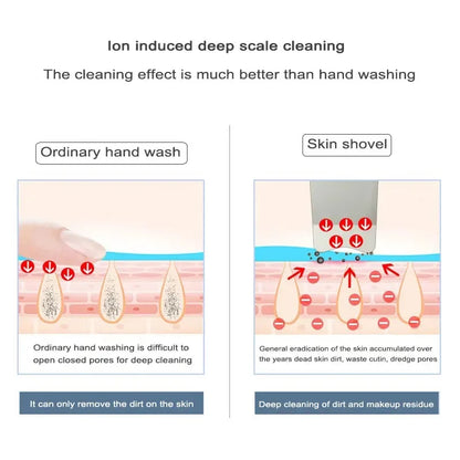 LumaSkin™ Ultrasonic Pore Scrubber & Blackhead Remover
