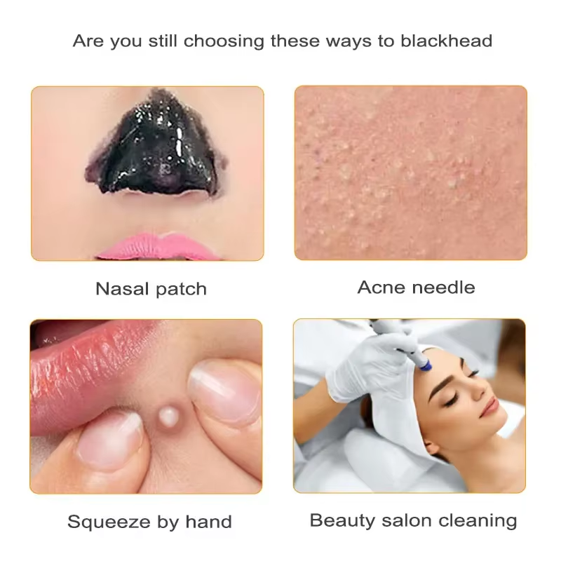 LumaSkin™ Ultrasonic Pore Scrubber & Blackhead Remover