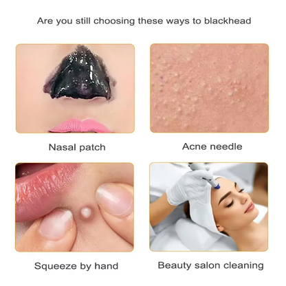 LumaSkin™ Ultrasonic Pore Scrubber & Blackhead Remover