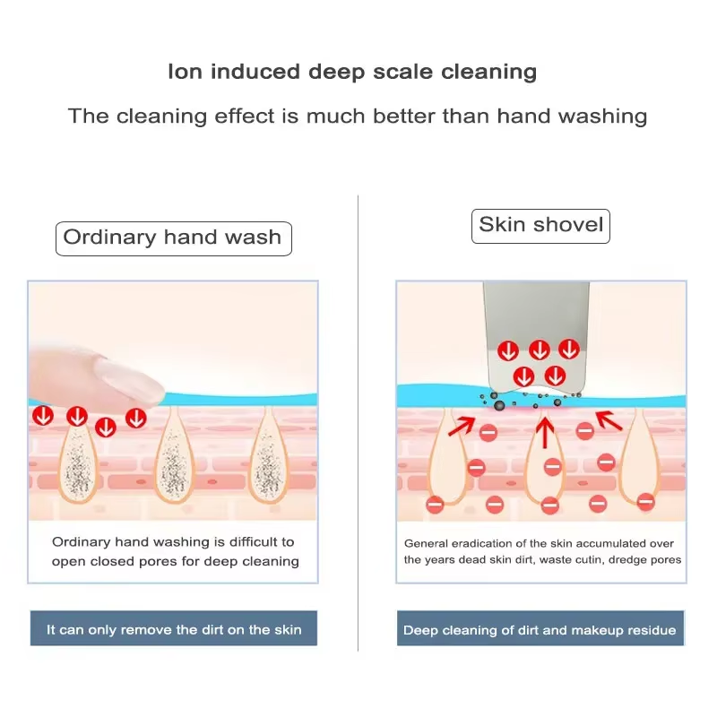 LumaSkin™ Ultrasonic Pore Scrubber & Blackhead Remover
