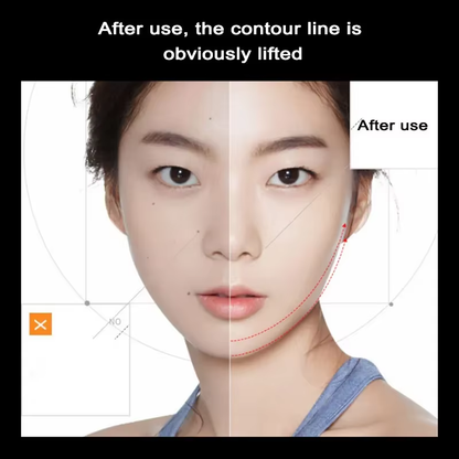 LumaSkin™ Ultrasonic Pore Scrubber & Blackhead Remover